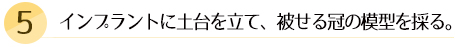 インプラントに土台を立て、被せる冠の模型を採る。