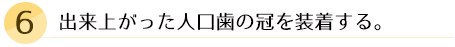 インプラントに土台を立て、被せる冠の模型を採る。