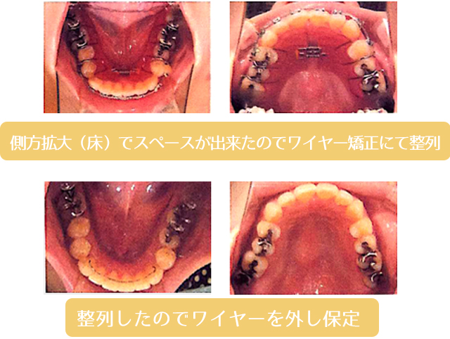 矯正歯科 審美矯正 ｜ つくば市の大久保歯科医院
