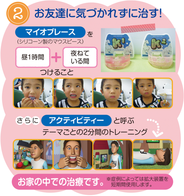 自分の力で治す１２歳までの歯並び マイオブレース矯正のご案内 